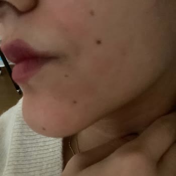 La Roche Posay Hyalu B5 Serum