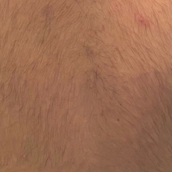 Suit Güzellik Merkezleri Suit Güzellik Lazer