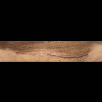 Özel Buhara Hastanesi Sezaryen Doğum