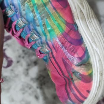 Skechers Üç Ayda Deforme Olan Ayakkabı İçin Telafi Talebi