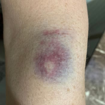 Medicana Hospitals Memnun Kalmadım Ve Şikayetçiyim