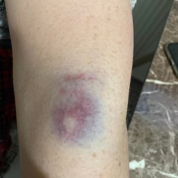 Medicana Hospitals Memnun Kalmadım Ve Şikayetçiyim