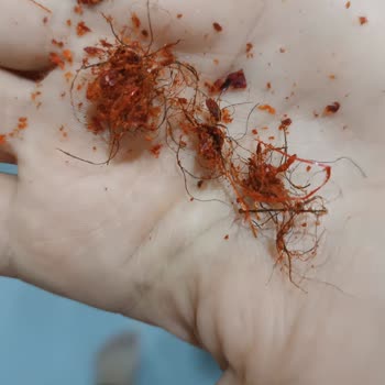 BİM Biberinden Çıkan Kıllar