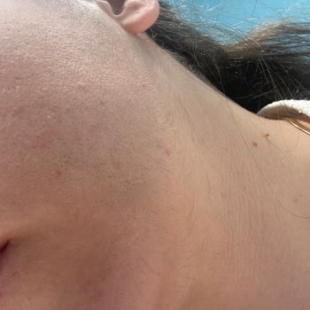 Medica Derma Dr. İstemi Damgacı Asla Yanarsınız