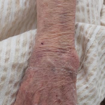 Epc Hastanesi Yoğun Bakım Servisi, Ölüm Servisi