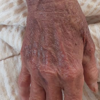 Epc Hastanesi Yoğun Bakım Servisi, Ölüm Servisi