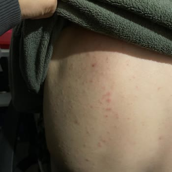 Veet Tüy Dökücü Mağduriyeti