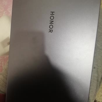 Honor Bilgisayarım Bozuldu Teknik Servis Yapamadığını Söylüyor