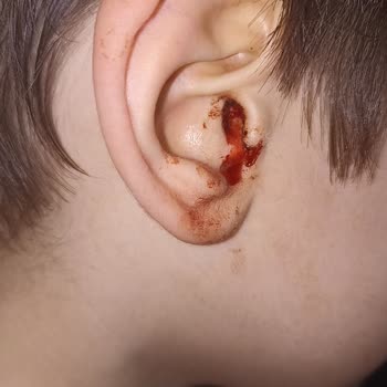 Kırkağaç Devlet Hastanesi Acil Doktor Müdahalesi