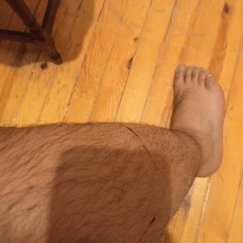 Selçuklu Belediyesi (Konya) Konya 4. OSB Girişi Köpek Saldırısı