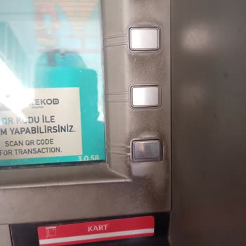 Ziraat Bankası ATM Hijyen Sorunu: Temizlik Bekliyoruz!