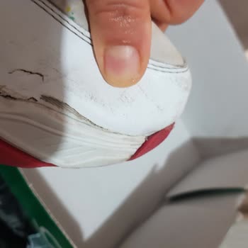 Boyner Benetton Marka Botta 7 Haftada Çatlak Yırtılma