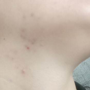 Dermoskin Celeritt SPF 25 Leke Karşıtı Bakım Kremi 30 Ml Etkisiz Krem