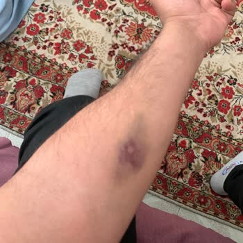 Erdemli Devlet Hastanesi Hemşire Bilgisizliği Alakasızlığı