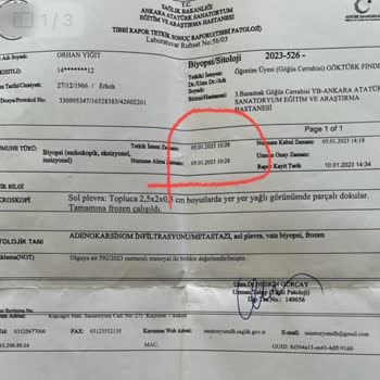 Yapı Kredi Vefat İşlemleri Sorunu