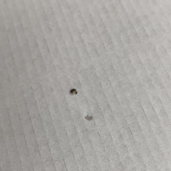 Trendyol Paketimden Böcek Yumurtaları Çıktı