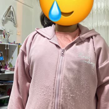 LCW Kıyafet Deforme, Kumaş Bitlenmesi