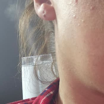 New Well Markasi Yüzümde Sivilce Çıkardı