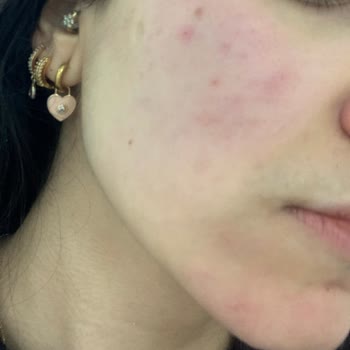 Perfetto Güzellik Salonu Gebze Vasat Cilt Bakımı