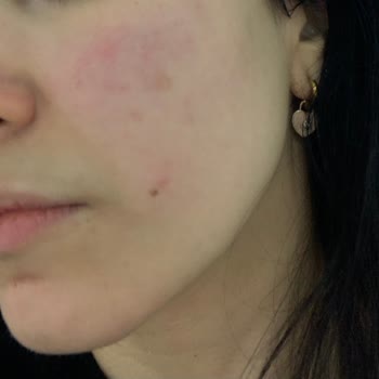 Perfetto Güzellik Salonu Gebze Vasat Cilt Bakımı