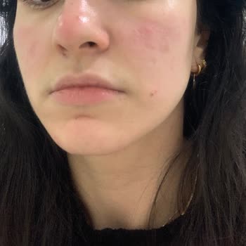 Perfetto Güzellik Salonu Gebze Vasat Cilt Bakımı