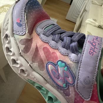 Skechers Ayakkabının Kalitesizliği, Kısa Sürede Patlaması