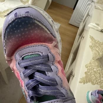 Skechers Ayakkabının Kalitesizliği, Kısa Sürede Patlaması