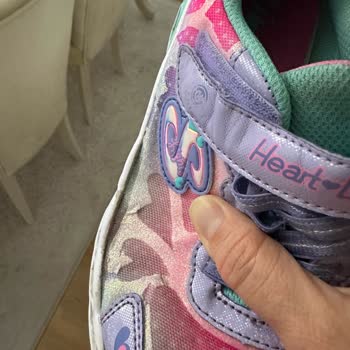 Skechers Ayakkabının Kalitesizliği, Kısa Sürede Patlaması