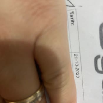 PHILIPS Ev Aletleri Philips Dikey Süpürge Çalışmıyor