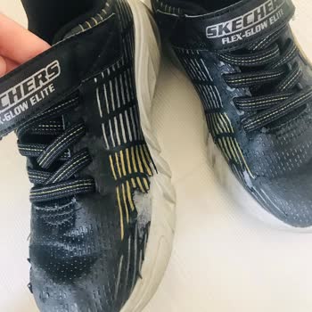 Skechers Ayakkabılar 6 Ayda Soyuldu!