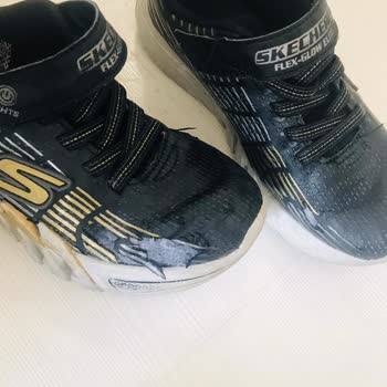 Skechers Ayakkabılar 6 Ayda Soyuldu!