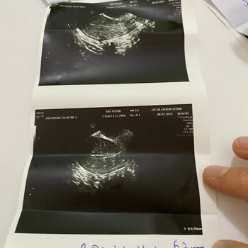 Atasam Tıp Merkezi Mağduriyeti Gidememesi