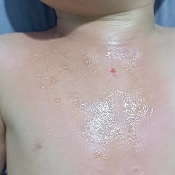 Sağlık Bakanlığı Siirt Özel İbni Sina Hastanesinde Acil Serviste Neden Ücret Alınıyor