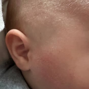 Mustela Konağı Engellemeyen Konak Şampuanı