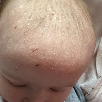 Mustela Konağı Engellemeyen Konak Şampuanı