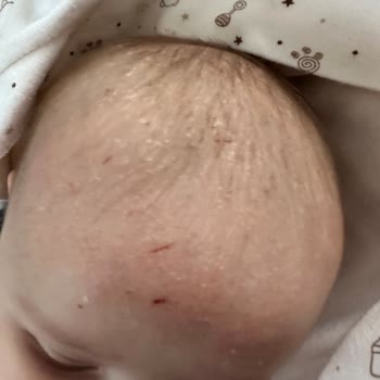 Mustela Konağı Engellemeyen Konak Şampuanı