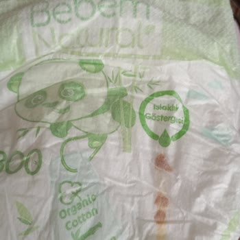 Bebem Natural Bebek Bezinin İçinden Yabancı Madde Çıktı