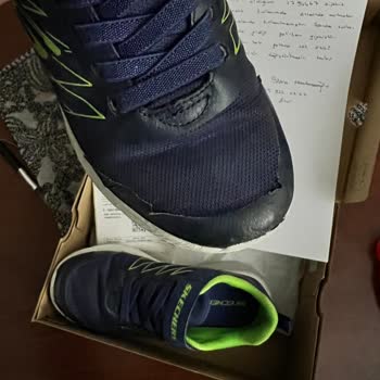 Skechers 15 Günlük Ayakkabı Şikayet