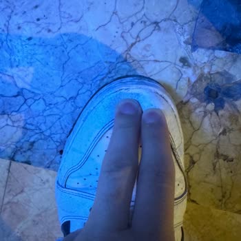 Deichmann Ayakkabıda Çatlaklar Ve Açılma