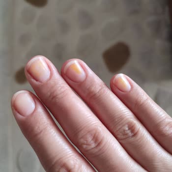 Flormar Ojenin Bıraktığı Sarı Leke