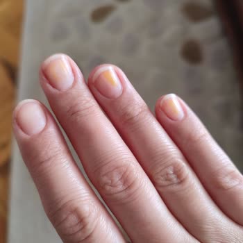 Flormar Ojenin Bıraktığı Sarı Leke