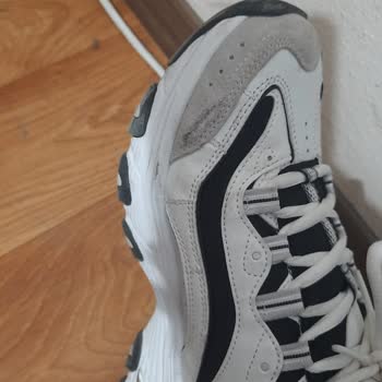 Sketchers Ürünün Arkasında Durmuyor