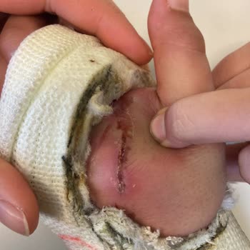 System Hospital Kolunda Hasar Kalabilir Ameliyat Gerekebilirmiş