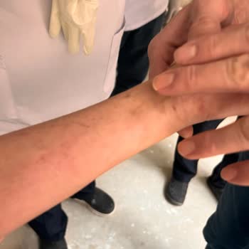 System Hospital Kolunda Hasar Kalabilir Ameliyat Gerekebilirmiş