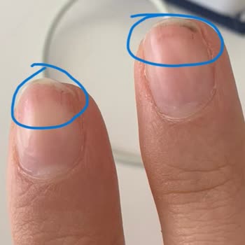 Watsons Tırnaklarımı Mahvetti Paramın İadesini İstiyorum