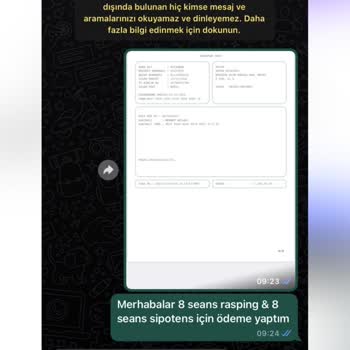 Dilan Polat Estetik Deprem Sonrası Hizmet Mağduriyeti