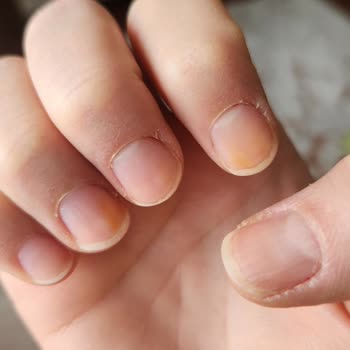 Flormar Ojenin Tırnakta Leke Bırakması