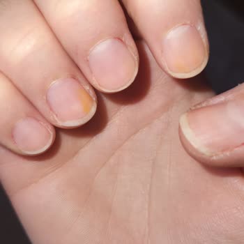 Flormar Ojenin Tırnakta Leke Bırakması