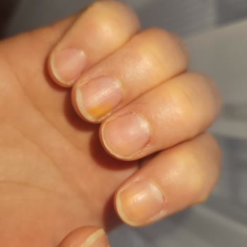 Flormar Ojenin Tırnakta Leke Bırakması