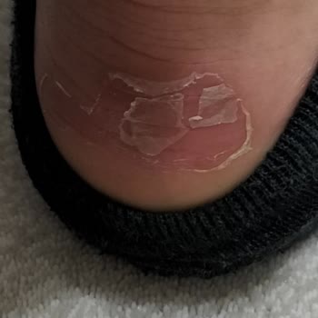 Nike FLO Ya Hiç Yakışmadı